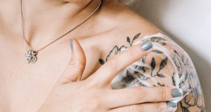 Tattoo Removal Options